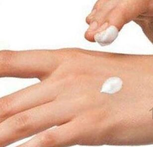 Ointment for the treatment of psoriasis